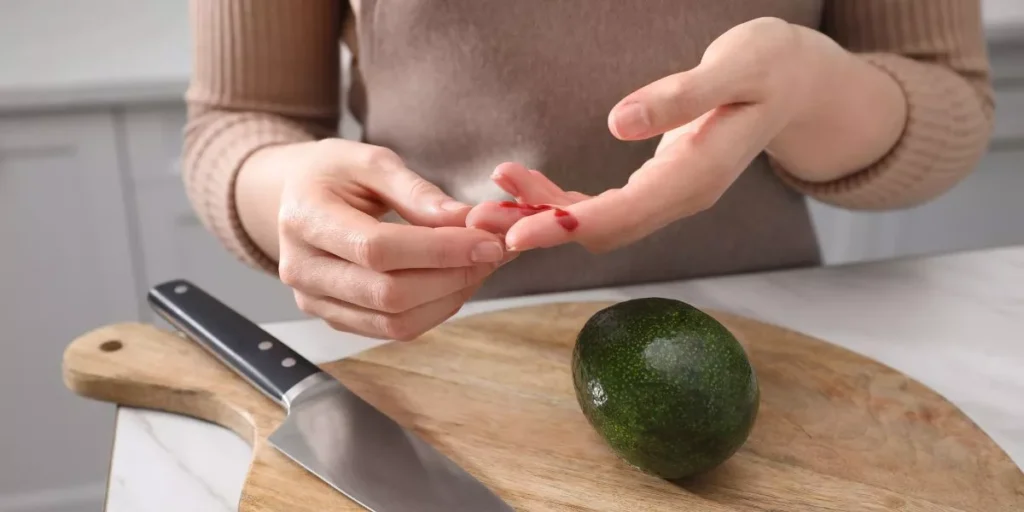 Quick Tips for Avoiding Common Kitchen Injuries Quick Tips for Avoiding Common Kitchen Injuries